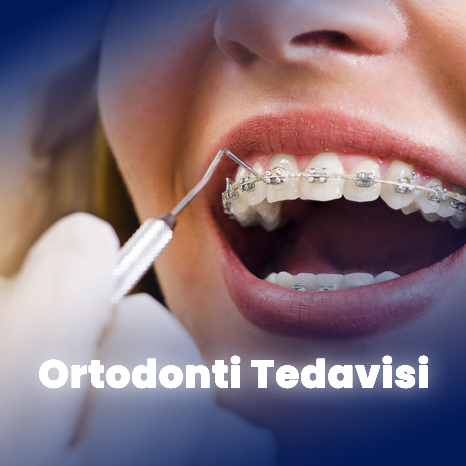 Ortodonti Tedavisi